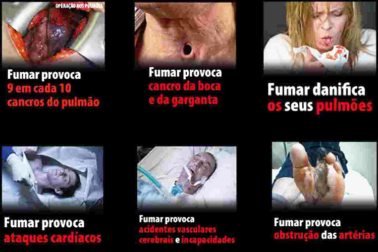 Fumar um maço de cigarro por dia durante um ano faz 150 mutações em células do pulmão